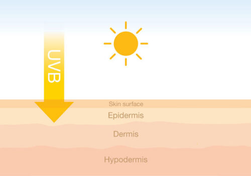 An illustration of the different layers of the skin with a yellow arrow going from a sun through to the epidermis to illustrate the ongoing burden of the keratinocyte skin cancers cutaneous squamous cell carcinoma and carcinoma in situ highlighted in a large registry study