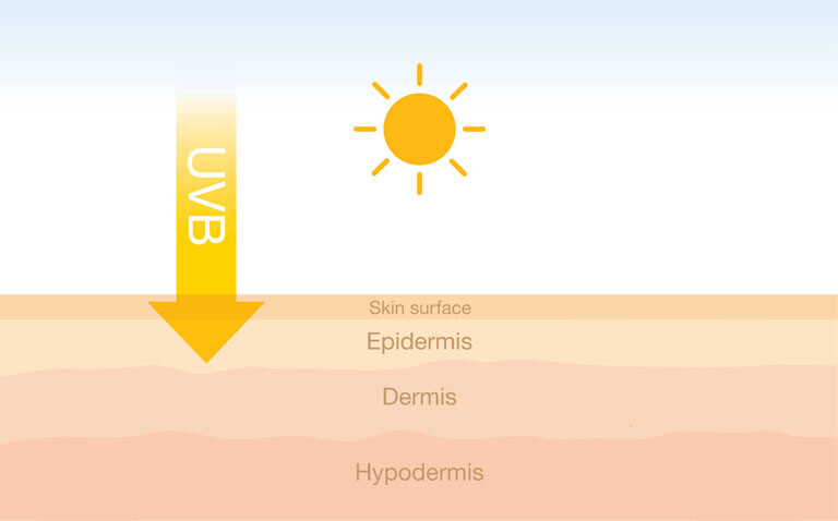 An illustration of the different layers of the skin with a yellow arrow going from a sun through to the epidermis to illustrate the ongoing burden of the keratinocyte skin cancers cutaneous squamous cell carcinoma and carcinoma in situ highlighted in a large registry study