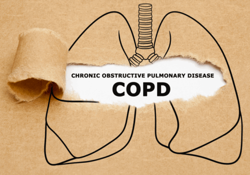 Oral anti-diabetic agents able to reduce COPD exacerbation risk