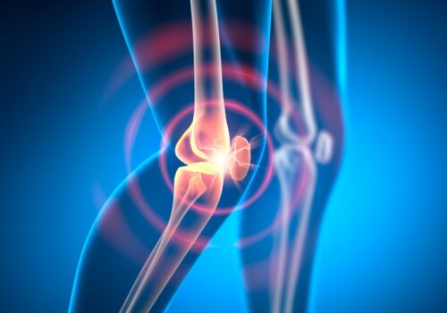 Medical illustration of a knee joint with bones visible, highlighted by a glowing red area and circular rings around the joint, indicating knee pain, inflammation and osteoarthritis and soft tissue changes on ultrasound