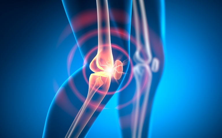 Medical illustration of a knee joint with bones visible, highlighted by a glowing red area and circular rings around the joint, indicating knee pain, inflammation and osteoarthritis and soft tissue changes on ultrasound
