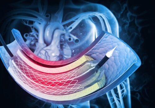 P2Y12 inhibitor mono-therapy after PCI