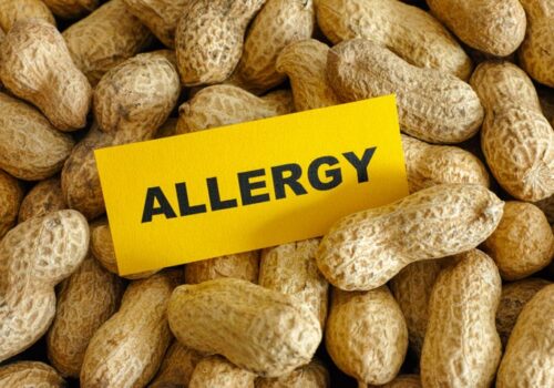 Peanut allergy leads to huge psychosocial burden among sufferers