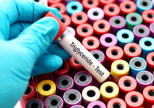 Pemafibrate fails to reduce cardiovascular events in type 2 diabetes