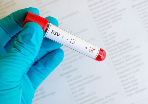 RSV vaccine shows high efficacy in older adults
