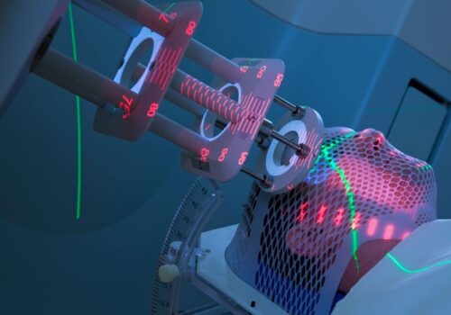 Radiotherapy use in cancer increases cardiovascular disease mortality risk
