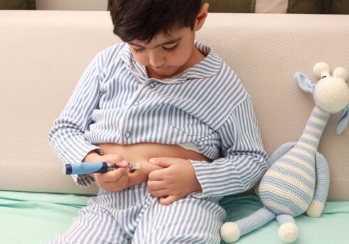 Risk of type 1 diabetes increased after COVID-19 in children and adolescents