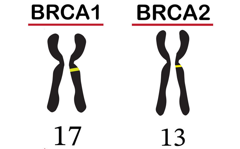 An illustration of chromosome 17 with the BRCA1 mutation highlighted and chromosome 13 with BRCA2 mutation highlighted to illustrate the finding that RRBM is linked with lower mortality in BRCA1 and BRCA2 carriers
