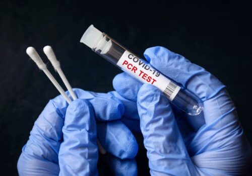 Screening-based predictive tools for COVID-19 in ED inferior to PCR test|Screening-based predictive tools for COVID-19 in ED inferior to PCR test