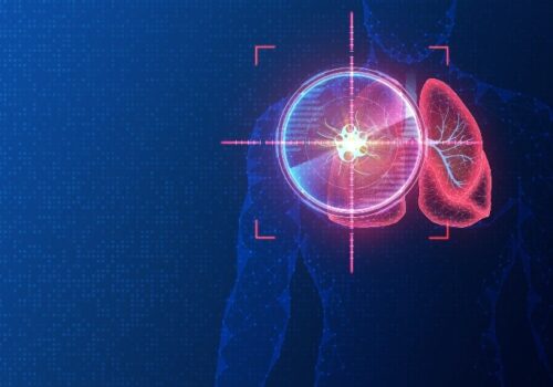 A digital illustration of a wirework human body on a blue background with the lungs highlighted in red and a target over the top to illustrate serial imaging-based deep learning effectively predicting survival in immunotherapy-treated NSCLC