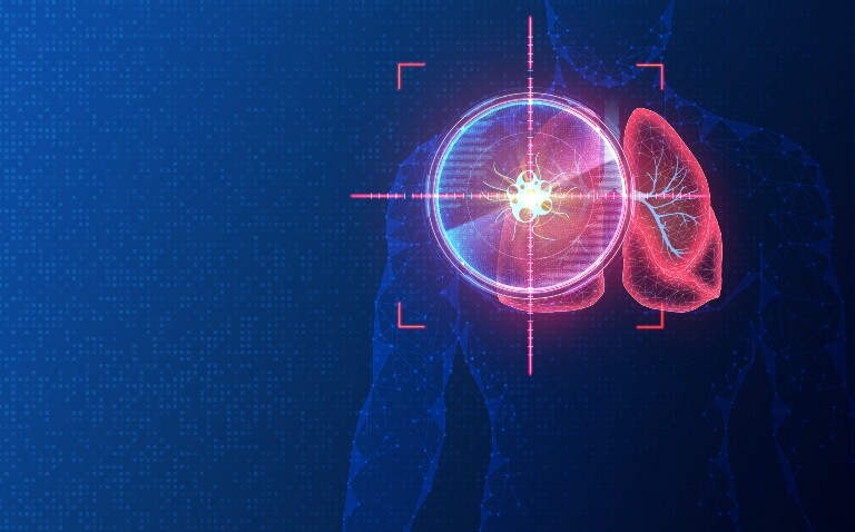 A digital illustration of a wirework human body on a blue background with the lungs highlighted in red and a target over the top to illustrate serial imaging-based deep learning effectively predicting survival in immunotherapy-treated NSCLC