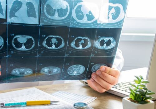 Standardised radiology alert system effective for incidental findings follow-up