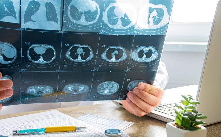 Standardised radiology alert system effective for incidental findings follow-up