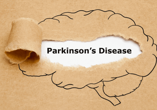 Subcutaneous foslevodopa foscarbidopa infusion improves control in Parkinson's disease