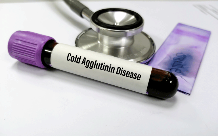 Sutimlimab approved in Europe for cold agglutinin haemolytic anaemia