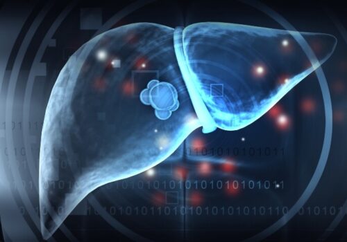 A digital illustration of a cancer cell in a liver to illustrate new research into colorectal cancer liver metastases