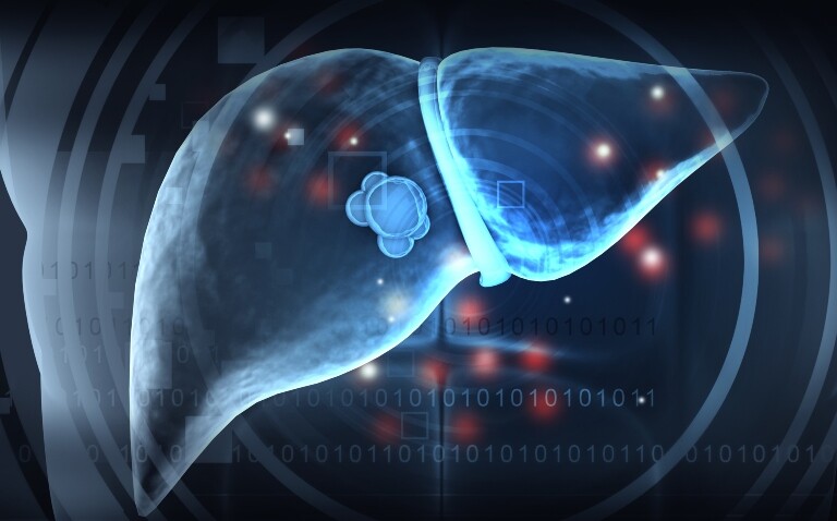 A digital illustration of a cancer cell in a liver to illustrate new research into colorectal cancer liver metastases