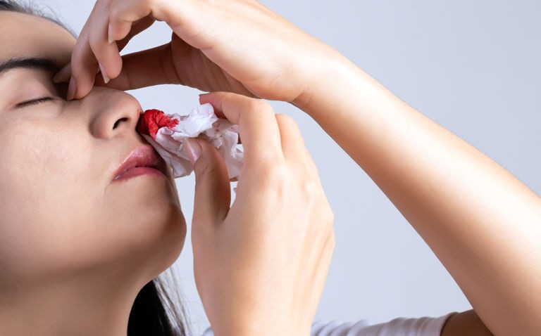 Topical tranexamic acid effective for epistaxis