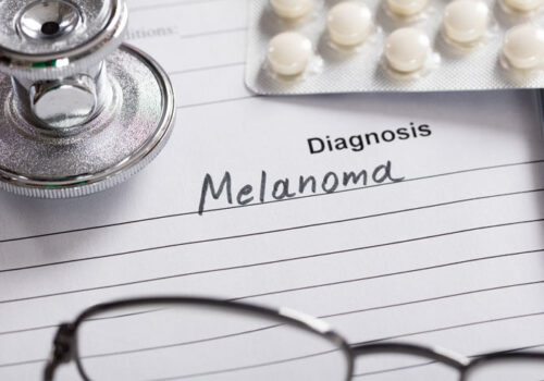 Tumour-infiltrating lymphocyte therapy superior to ipilimumab in advanced melanoma