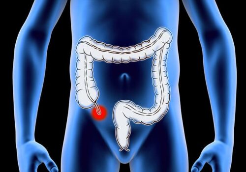 Ultrasound is sensitive and specific for initial diagnosis of acute appendicitis in ED