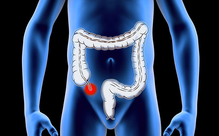 Ultrasound is sensitive and specific for initial diagnosis of acute appendicitis in ED
