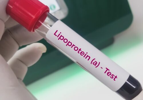 A white-gloved hand holding a test tube of blood with a label saying Lipoprotein(a) Test to illustrate that very elevated levels correlates with increased cardiovascular risk