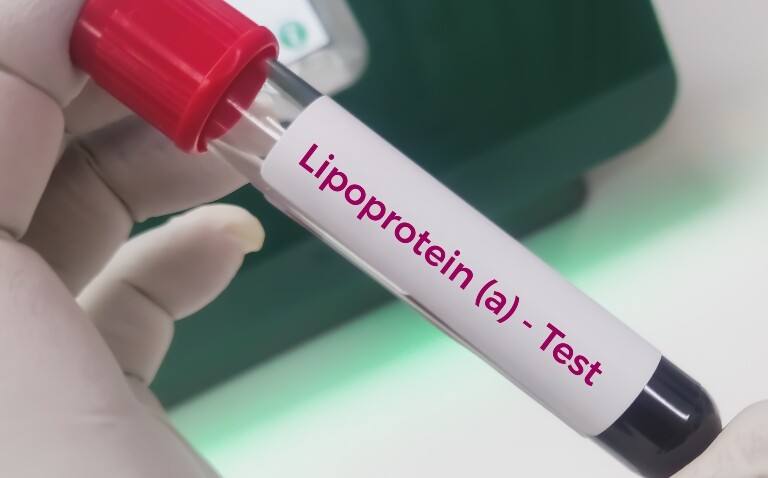 A white-gloved hand holding a test tube of blood with a label saying Lipoprotein(a) Test to illustrate that very elevated levels correlates with increased cardiovascular risk