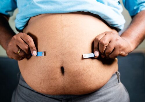 Weekly tirzepatide provides substantial reductions in body weight