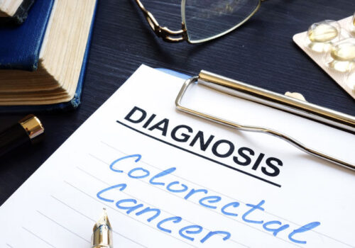 miRNA plasma signature enables diagnosis of early onset colorectal cancer