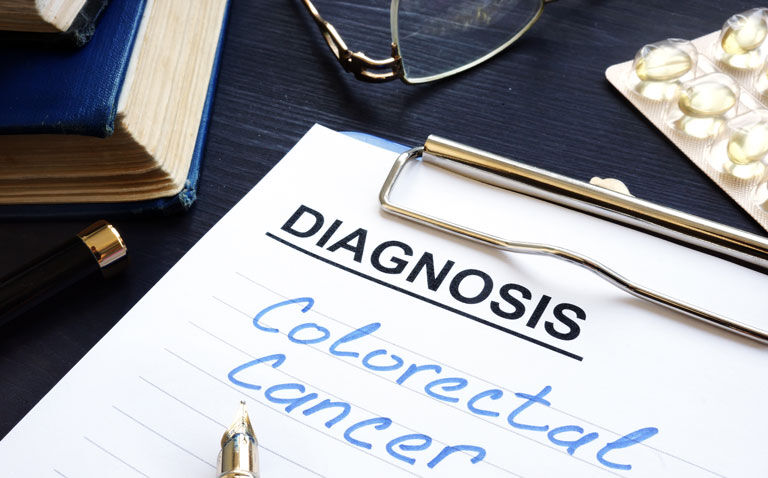 miRNA plasma signature enables diagnosis of early onset colorectal cancer