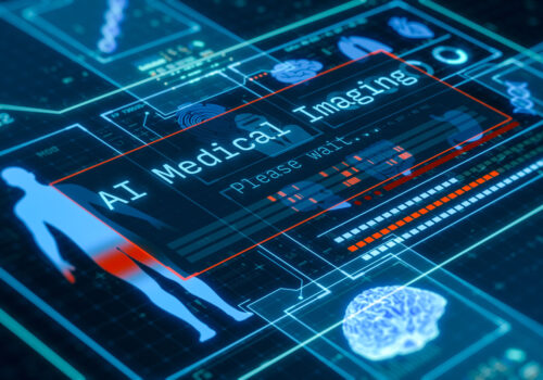 Digital interface displaying the words ‘AI Medical Imaging’ with medical scans, a human body outline, and brain graphics on a blue high-tech background, representing artificial intelligence in cancer diagnostics and the SMMILe algorithm