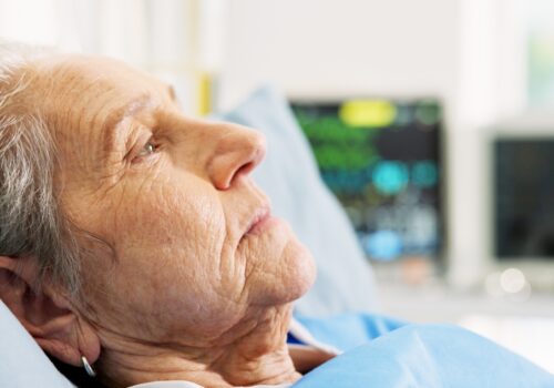 Close-up side profile of an elderly woman lying in a hospital bed with blurred medical monitors in the background to illustrate the exploration of invasive vs conservative strategies for frail older adults with NSTEMI