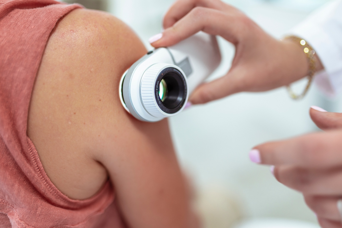 AI skin cancer diagnosis falls short of expert physicians in real-world assessment