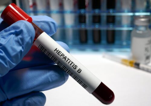 A pathologist holding a test tube containing blood with the words Hepatitis B on the label above a barcode against a backdrop of a rack of test tubes to illustrate the finding that bepirovirsen delivers a ‘functional cure’ for chronic hepatitis B virus infections