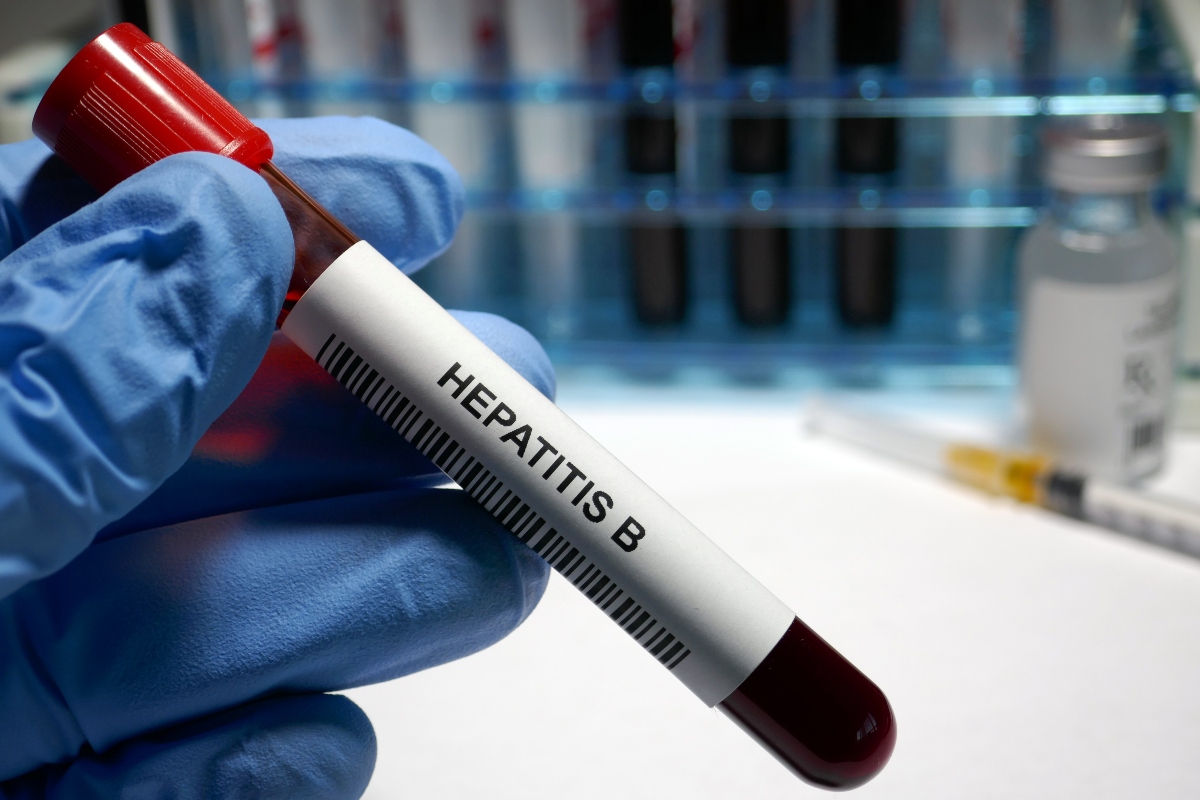 A pathologist holding a test tube containing blood with the words Hepatitis B on the label above a barcode against a backdrop of a rack of test tubes to illustrate the finding that bepirovirsen delivers a ‘functional cure’ for chronic hepatitis B virus infections