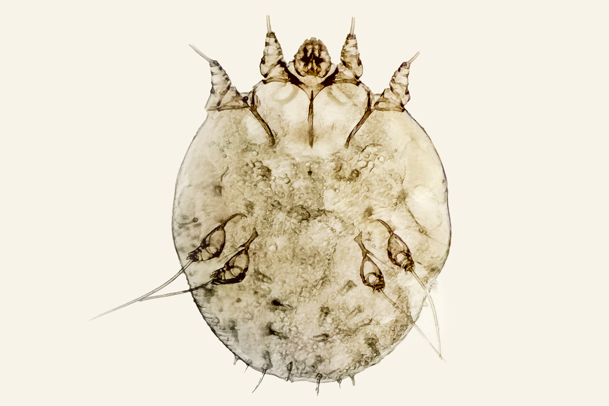 A microscopic view of a Sarcoptes scabiei to illustrate the finding that higher-dose ivermectin combined with permethrin offers no advantage over standard regimen for severe scabies