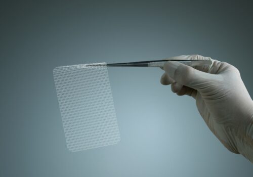 A white-gloved hand holding a piece of surgical mesh in a pair of metal tweezers against a blue-green background to illustrate mesh placement being linked to recurrence and bowel obstruction risk after ventral hernia repair