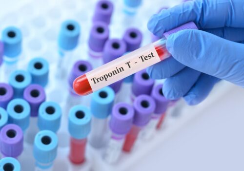 Doctor wearing a blue glove holding a test blood sample tube with Troponin T test on the label against a background of medical test tubes to illustrate a novel sixth-generation troponin T assay doubling the rapid rule-out of myocardial infarction in EDs