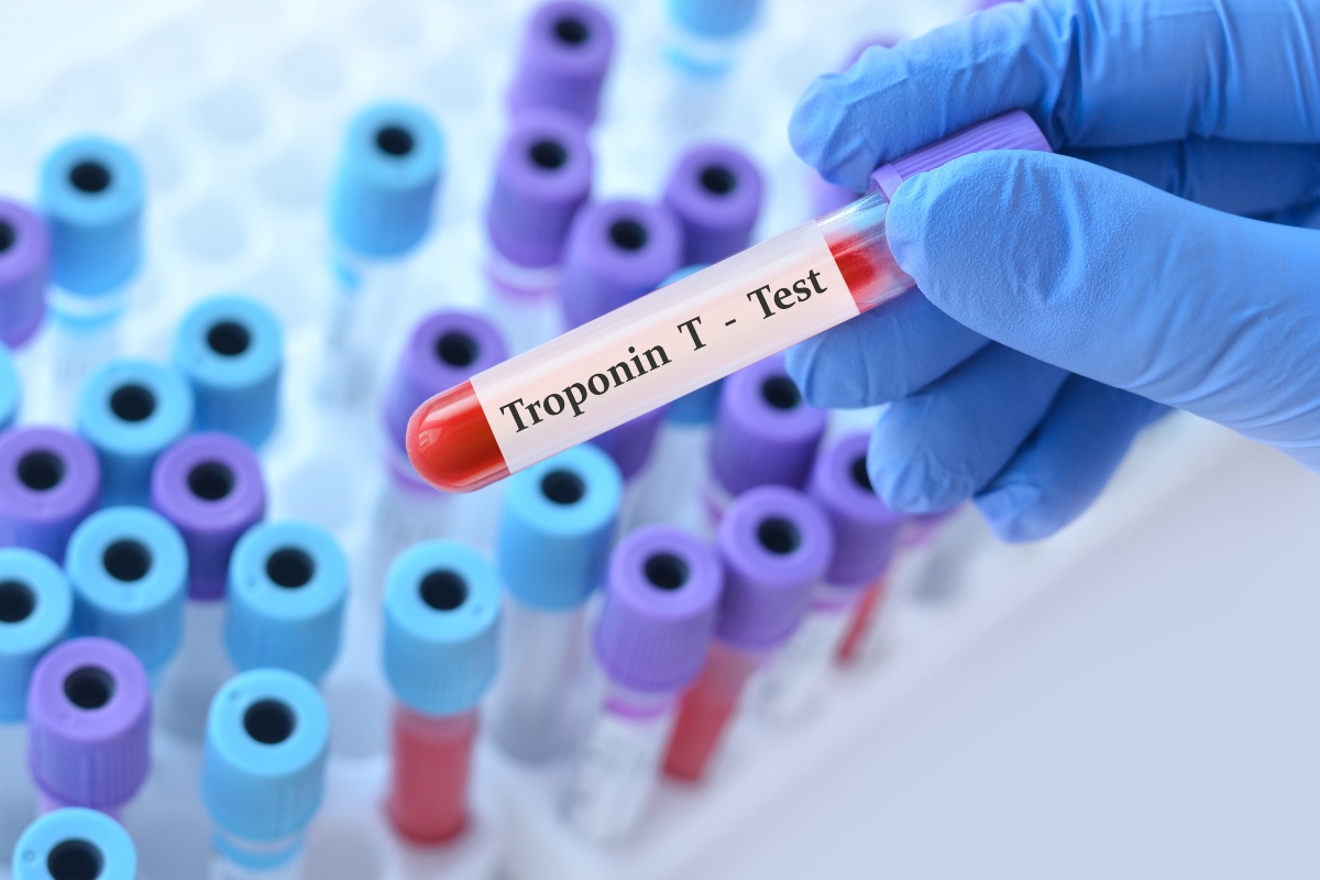 Doctor wearing a blue glove holding a test blood sample tube with Troponin T test on the label against a background of medical test tubes to illustrate a novel sixth-generation troponin T assay doubling the rapid rule-out of myocardial infarction in EDs