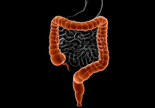 Medical illustration of the digestive tract showing the large intestine highlighted in orange surrounding the small intestine in white, against a black background to illustrate upadacitinib demonstrating one-year effectiveness in refractory perianal Crohn’s disease
